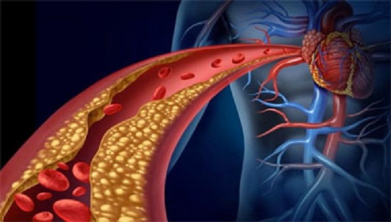 ரத்தக் குழாய்களை பாதிக்கும் டிரான்ஸ் பேட் கொழுப்பு!