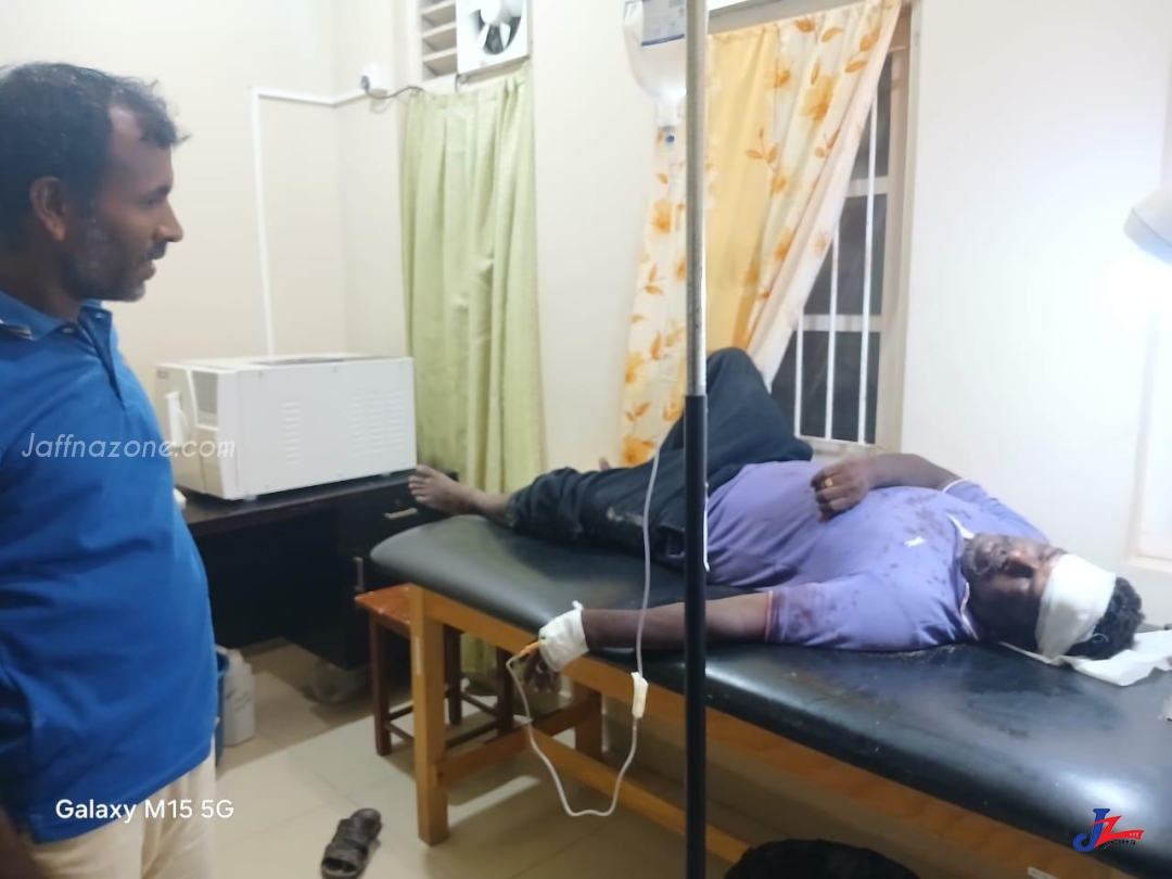 நெடுந்தீவு பிரதேச சபை வேட்பாளர் மீது தாக்குதல்